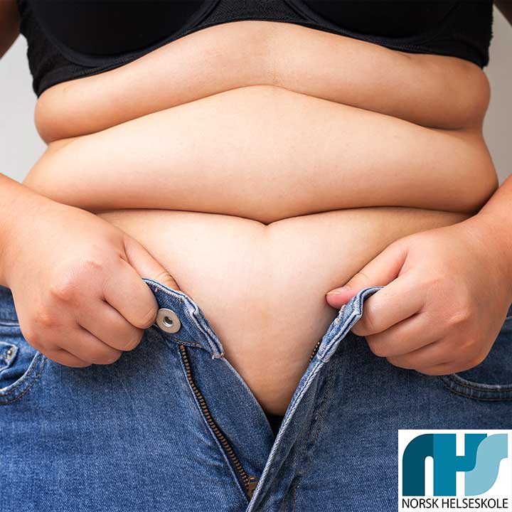 Overvekt Overvekt Norsk Helseskole Kurs Utdanning Livsstilsendring Livsstilsveiledning